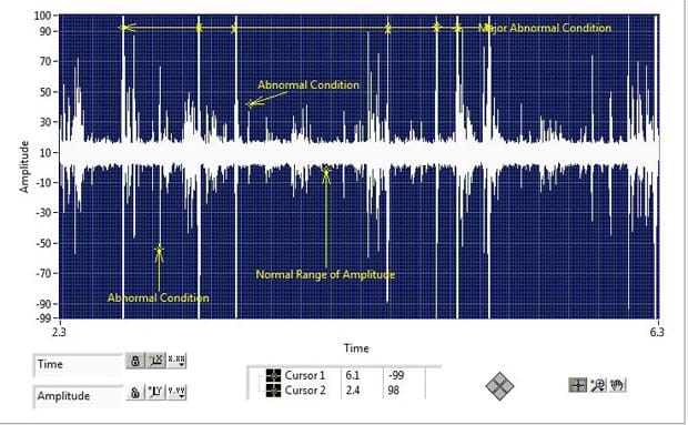 ue-systems-25042016-cnt1